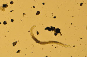 Higher temperatures have led to the decline of the nematode Scottnema lindsayae, seen here through a microscope.